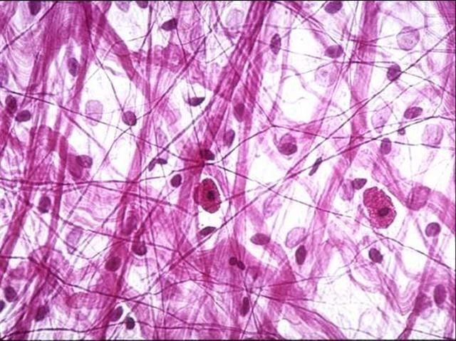 Dense irregular connective tissue fibres
