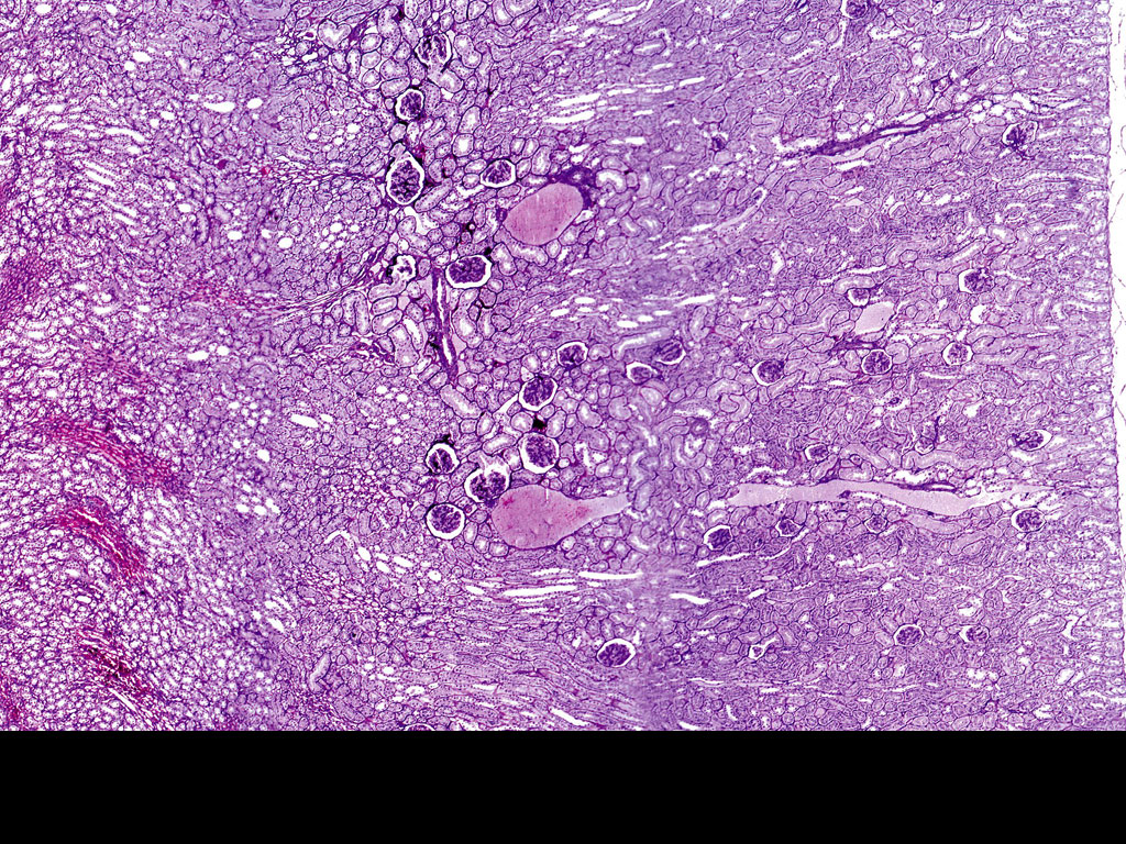 High magnification of renal corpuscle and surrounding tubules
